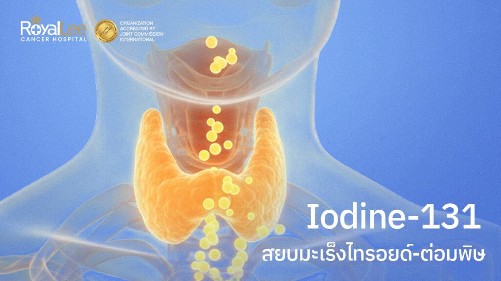 Iodine-131 (Radionuclide Therapy) สยบมะเร็งไทรอยด์-ต่อมพิษ