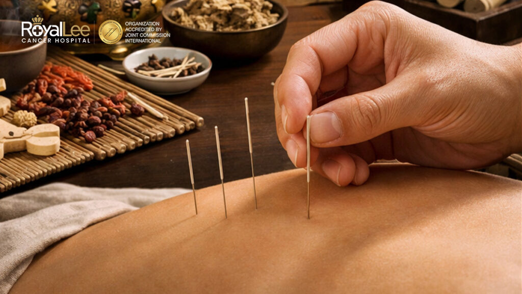 TCM การแพทย์แผนจีน ผสมผสานการรักษามะเร็ง