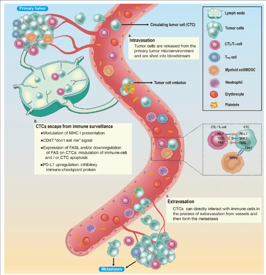 ภาพที่ 1: วงจรการแพร่กระจายของมะเร็ง (Metastatic Cascade) แสดงสามขั้นตอนหลัก ได้แก่ (a) การเข้าสู่กระแสเลือด (Intravasation) — เซลล์มะเร็งหลุดจากก้อนมะเร็งต้นกำเนิดและกลายเป็น CTCs ในกระแสเลือด (b) การหลบหลีกภูมิคุ้มกัน (Immune Evasion) — CTCs ใช้กลไกต่างๆ เช่น CD47, PD-L1 และการลด MHC-I เพื่อหลีกเลี่ยงการถูกทำลาย และ (c) การออกจากหลอดเลือดและก่อตัวเป็นก้อนมะเร็งใหม่ (Extravasation and Metastasis)
ที่มา: Zhong X, Zhang H, Zhu Y, et al. Circulating tumor cells in cancer patients: developments and clinical applications for immunotherapy. Molecular Cancer. 2020;19(1):15. https://doi.org/10.1186/s12943-020-1141-9 — เผยแพร่ภายใต้สัญญาอนุญาต Creative Commons Attribution 4.0 International (CC BY 4.0)