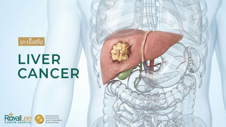 มะเร็งตับ (Liver Cancer)