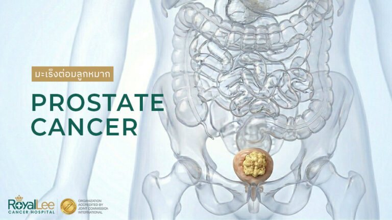 มะเร็งต่อมลูกหมาก Prostate Cancer