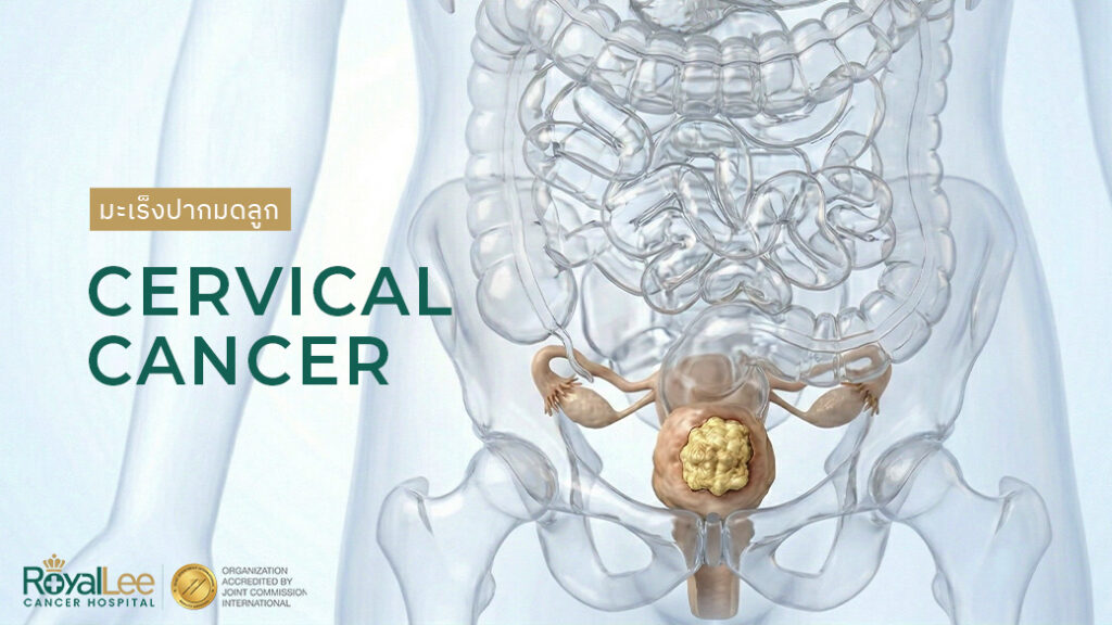 มะเร็งปากมดลูก Cervical Cancer