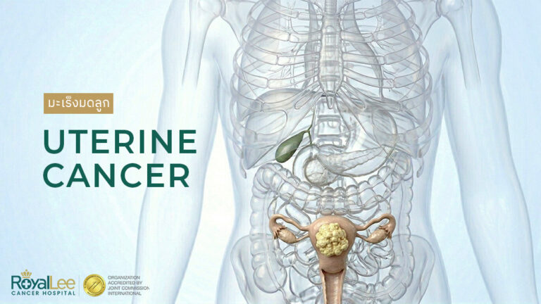 มะเร็งมดลูก Uterine Cancer